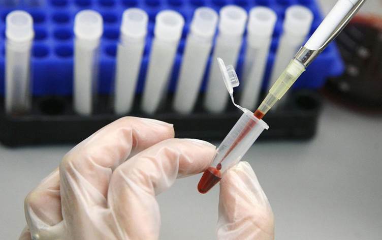 HIV tedavisinde tarihi adım: Virüs hücre içinde görünür hâle getirildi